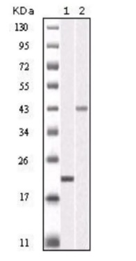 WB analysis. (Creative Biolabs Original)