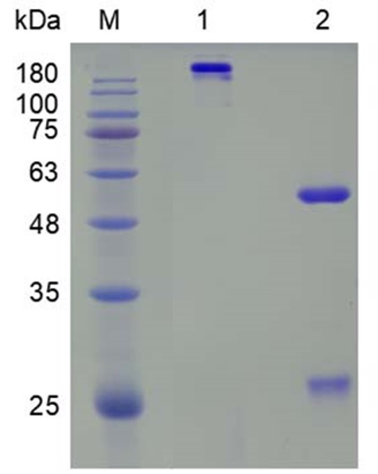 Fig.1 SDS-PAGE analysis. (Creative Biolabs Original)