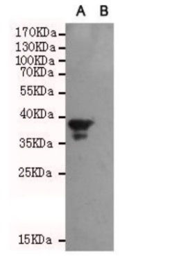 WB analysis. (Creative Biolabs Original)