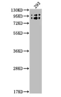 Fig.2 WB analysis. (Creative Biolabs Original)