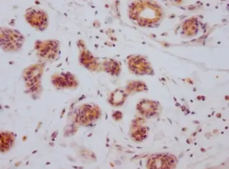 IHC analysis. (Creative Biolabs Original)