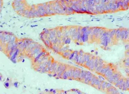 IHC analysis. (Creative Biolabs Original)