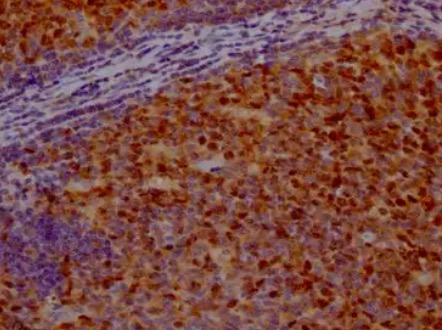 IHC analysis. (Creative Biolabs Original)