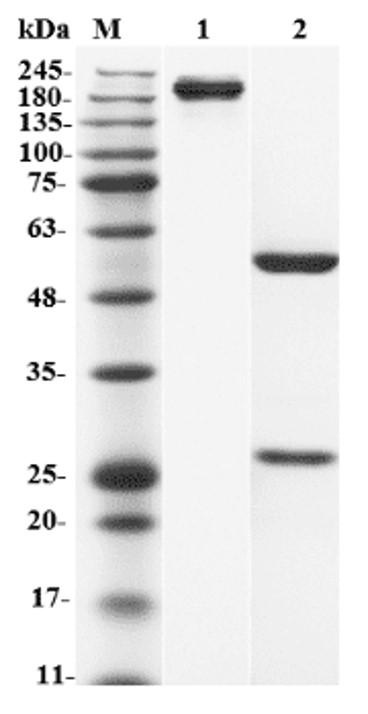 Fig.1 SDS-PAGE analysis. (Creative Biolabs Original)