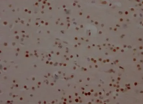 IHC analysis. (Creative Biolabs Original)