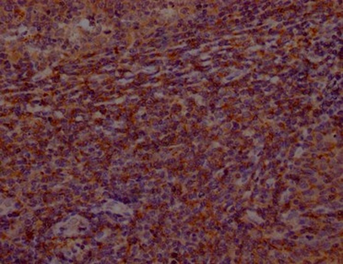 Fig.1 IHC analysis. (Creative Biolabs Original)