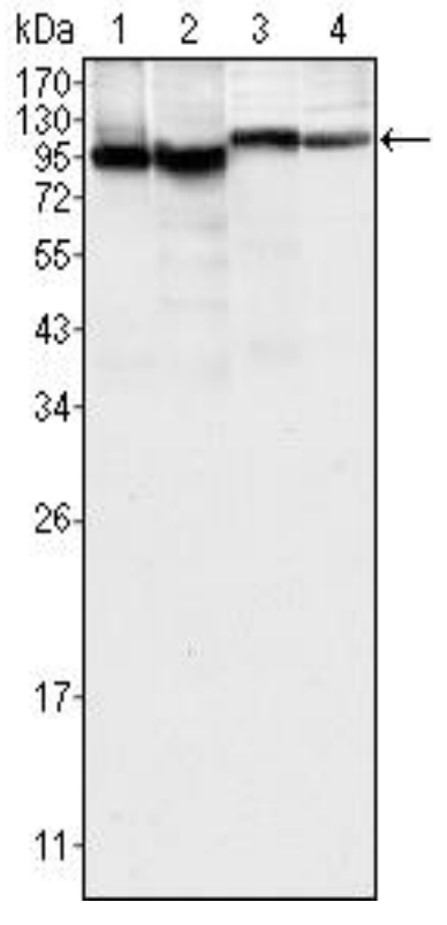 Fig.2 WB analysis. (Creative Biolabs Original)