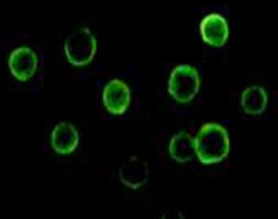 Fig.4 IF analysis. (Creative Biolabs Original)