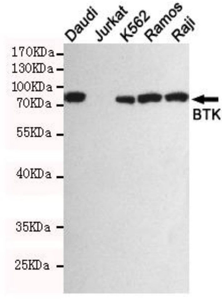 Fig.5 WB analysis. (Creative Biolabs Original)