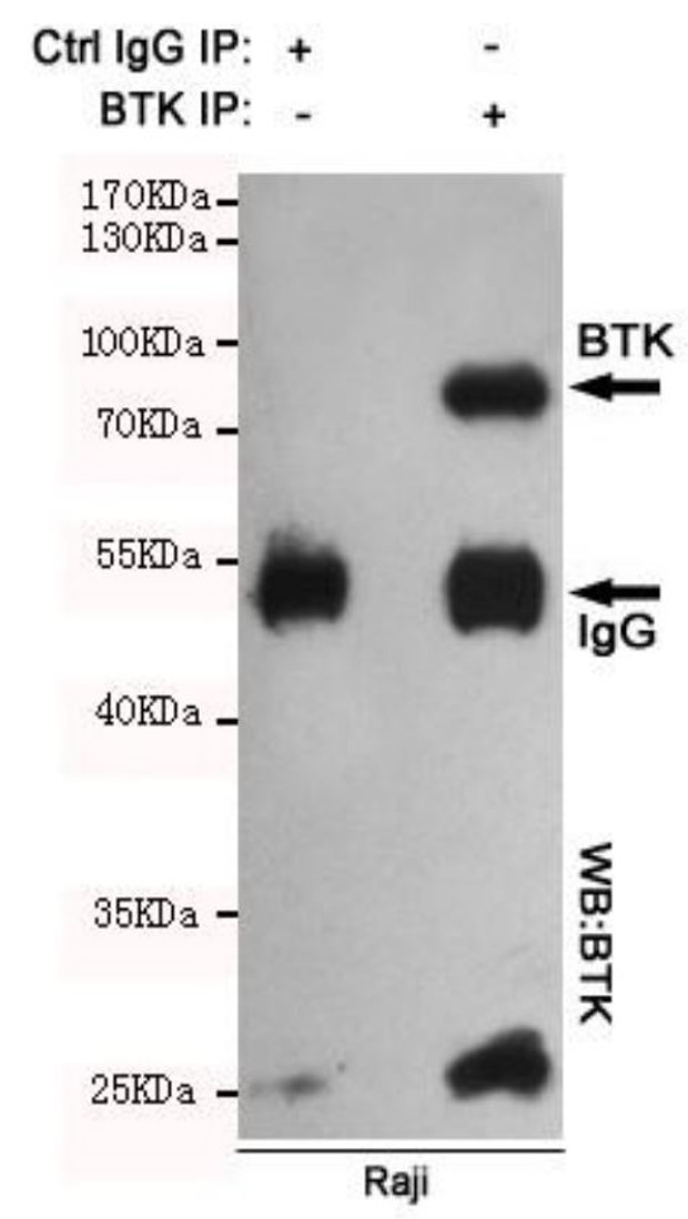 Fig.6 IP analysis. (Creative Biolabs Original)