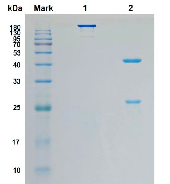 Fig.1 SDS-PAGE analysis. (Creative Biolabs Original)