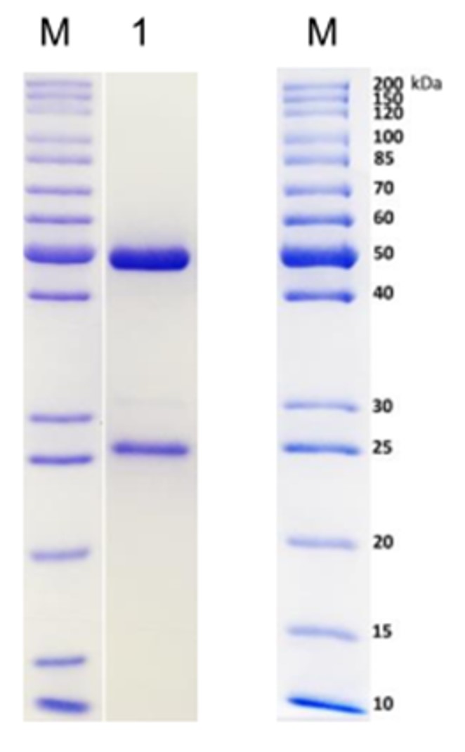 Fig.3 SDS-PAGE analysis. (Creative Biolabs Original)
