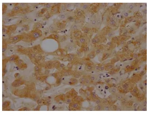 Fig.1 IHC analysis. (Creative Biolabs Original)