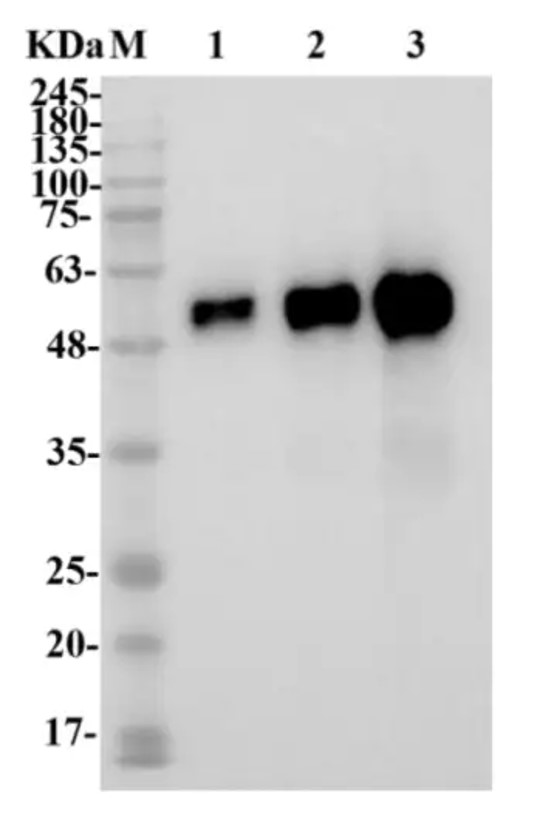 Fig.1 WB analysis. (Creative Biolabs Original)