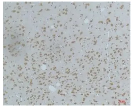 Fig.1 IHC analysis. (Creative Biolabs Original)