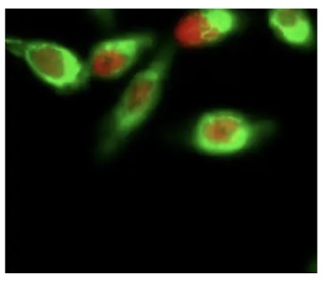 Fig.1 IF analysis. (Creative Biolabs Original)