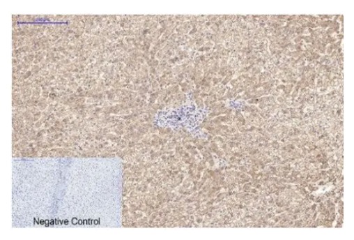 Fig.2 IHC analysis. (Creative Biolabs Original)