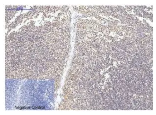 Fig.2 IHC analysis. (Creative Biolabs Original)