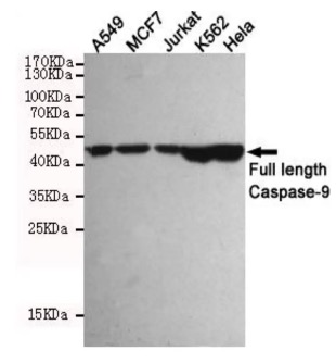 Fig.1 WB analysis. (Creative Biolabs Original)