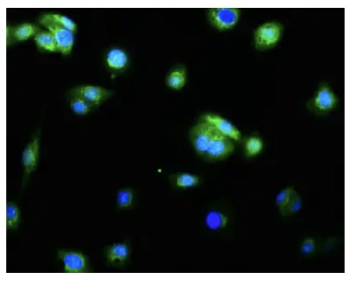 Fig.2 IF analysis. (Creative Biolabs Original)
