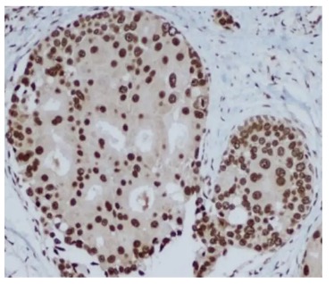Fig.3 IHC analysis. (Creative Biolabs Original)