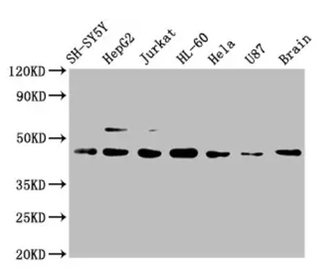 Fig.1 WB analysis. (Creative Biolabs Original)
