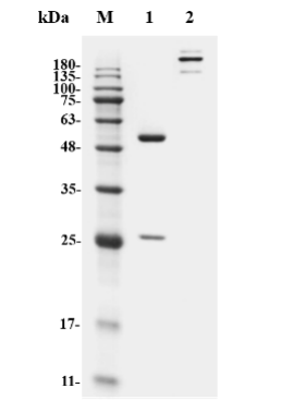 Fig.1 SDS-PAGE analysis. (Creative Biolabs Original)