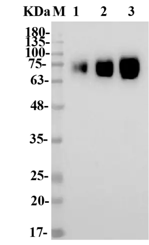 Fig.4 WB analysis. (Creative Biolabs Original)