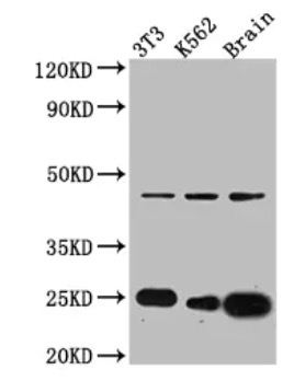 Fig.1 WB analysis. (Creative Biolabs Original)