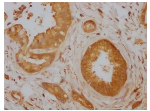 Fig.2 IHC analysis. (Creative Biolabs Original)