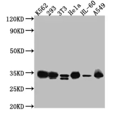 Fig.1 WB analysis. (Creative Biolabs Original)