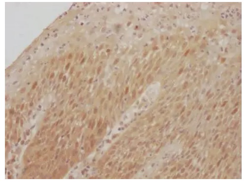 Fig.2 IHC analysis. (Creative Biolabs Original)