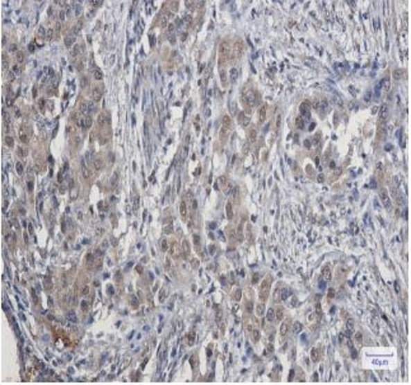 Fig.2 IHC analysis. (Creative Biolabs Original)