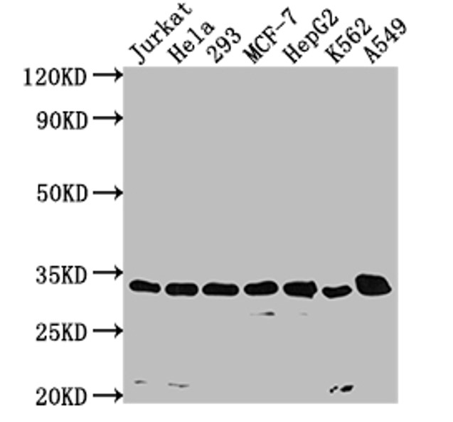 Fig.3 WB analysis. (Creative Biolabs Original)