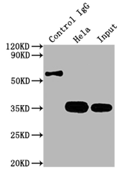 Fig.4 IP analysis. (Creative Biolabs Original)