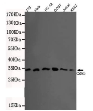 Fig.1 WB analysis. (Creative Biolabs Original)
