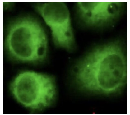 Fig.2 ICC analysis. (Creative Biolabs Original)