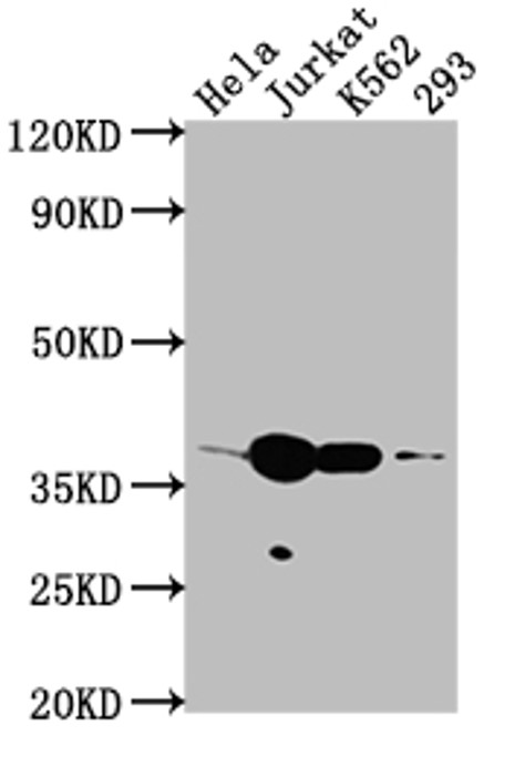 Fig.2 WB analysis. (Creative Biolabs Original)