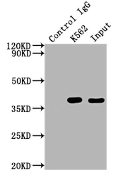 Fig.3 IP analysis. (Creative Biolabs Original)