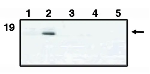 Fig.1 WB analysis. (Creative Biolabs Original)
