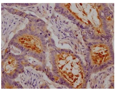 Fig.1 IHC analysis. (Creative Biolabs Original)