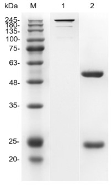 Fig.1 SDS-PAGE analysis. (Creative Biolabs Original)