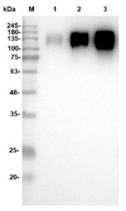 Fig.3 WB analysis. (Creative Biolabs Original)