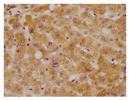 Fig.1 IHC analysis. (Creative Biolabs Original)