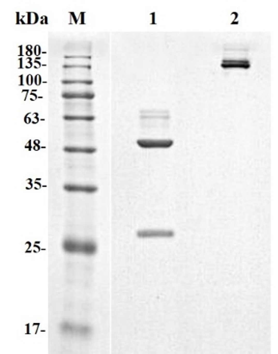 Fig.1 SDS-PAGE analysis. (Creative Biolabs Original)