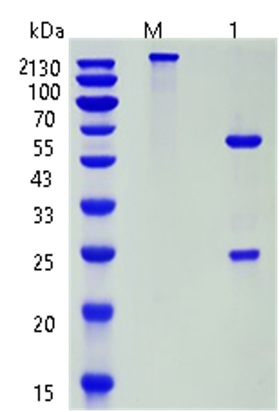 Fig.5 SDS-PAGE analysis. (Creative Biolabs Original)