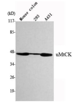 Fig.1 WB analysis. (Creative Biolabs Original)