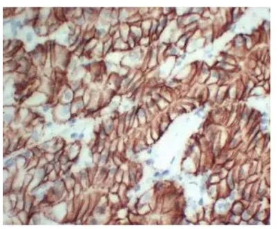 Fig.3 IHC analysis. (Creative Biolabs Original)