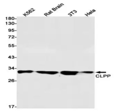 Fig.1 WB analysis. (Creative Biolabs Original)