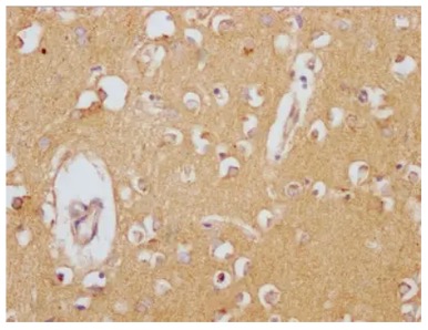 Fig.1 IHC analysis. (Creative Biolabs Original)